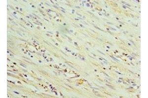 Immunohistochemistry of paraffin-embedded human epityphlon tissue using ABIN7172096 at dilution of 1:100 (THBS3 抗体  (AA 787-956))