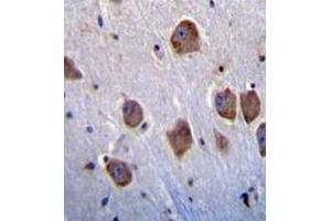 Immunohistochemistry analysis in human brain tissue (formalin-fixed, paraffin-embedded) using NT5DC4  Antibody , followed by peroxidase conjugation of the secondary antibody and DAB staining. (NT5DC4 抗体  (Middle Region))