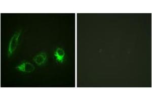 Immunofluorescence analysis of HeLa cells, using IRS-1 (Phospho-Ser323) Antibody. (IRS1 抗体  (pSer323))