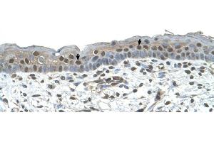 Immunohistochemistry (IHC) image for anti-Nuclear Receptor Subfamily 2, Group C, Member 2 (NR2C2) (C-Term) antibody (ABIN2783187)