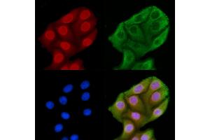 ABIN6262710 and ABIN6269260 staining HepG2 cells by IF/ICC. (JNK 抗体)