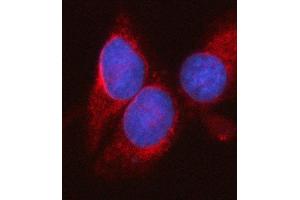 IF analysis of SYT16 using anti-SYT16 antibody (ABIN7599425). (SYT16 抗体  (AA 1-474))