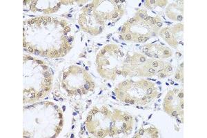 Immunohistochemistry of paraffin-embedded Human stomach using CGB7 Polyclonal Antibody at dilution of 1:100 (40x lens). (CGB7 抗体)