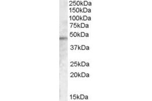 Western Blotting (WB) image for anti-Cytohesin 1 Interacting Protein (CYTIP) (C-Term) antibody (ABIN2156667) (CYTIP 抗体  (C-Term))