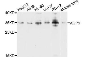 Western blot analysis of extracts of various cells, using AQP9 antibody. (AQP9 抗体)