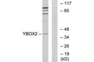 Western blot analysis of extracts from COLO205 cells, using YBOX2 Antibody. (YBX2 抗体  (AA 281-330))