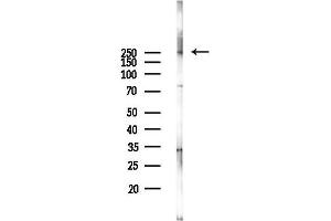Western blot analysis of lysates from Hela cells(LPS 4h treatment), using mTOR Antibody at 1/1000 dilution.