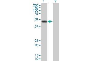 Western Blot analysis of HEAB expression in transfected 293T cell line by HEAB monoclonal antibody (M01), clone 8D5.