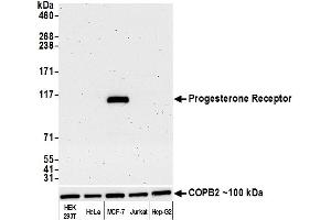 Western Blotting (WB) image for anti-Progesterone Receptor (PGR) antibody (ABIN7455133)