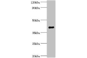 Western blot All lanes: Endophilin-B1 antibody at 2 μg/mL + Mouse kidney tissue Secondary Goat polyclonal to rabbit IgG at 1/10000 dilution Predicted band size: 41, 44, 30 kDa Observed band size: 41 kDa (SH3GLB1 抗体  (AA 1-365))