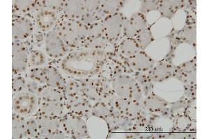 Immunostaining (ISt) image for anti-SplA/ryanodine Receptor Domain and SOCS Box Containing 2 (SPSB2) (AA 1-90) antibody (ABIN566591)