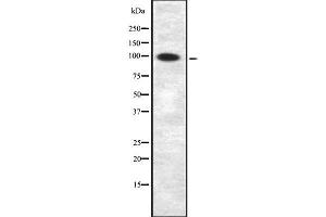 Western blot analysis of APBB1IP using COLO205 whole  lysates. (Amyloid beta (A4) Precursor Protein-Binding, Family B, Member 1 Interacting Protein (APBB1IP) (Internal Region) 抗体)