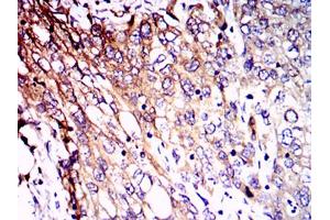 Immunohistochemistry (IHC) image for anti-Neurofilament, Light Polypeptide (NEFL) antibody (ABIN1108416)