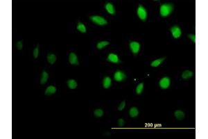 Immunofluorescence of monoclonal antibody to SETX on HeLa cell. (Senataxin (SETX) (AA 2579-2676) 抗体)