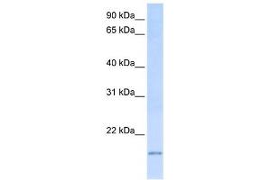 C20ORF30 antibody used at 1 ug/ml to detect target protein. (C20orf30 抗体  (C-Term))