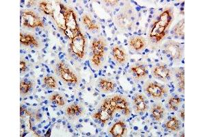 IHC-P: Connexin 32 antibody testing of rat kidney tissue (GJB1 抗体  (Middle Region))