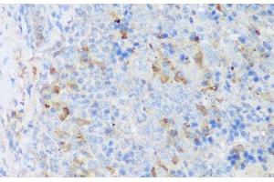 Immunohistochemistry of paraffin-embedded Mouse spleen using CRACR2A Polyclonal Antibody at dilution of 1:150 (40x lens). (EFCAB4B 抗体)