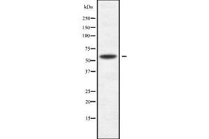 Western blot analysis of ACVR2B using K562 whole cell lysates (ACVR2B 抗体  (Internal Region))