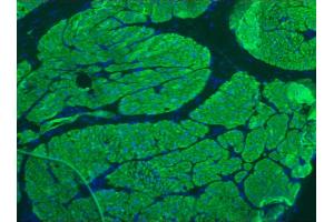 Image no. 1 for anti-Smoothelin (SMTN) antibody (ABIN335397) (Smoothelin 抗体)