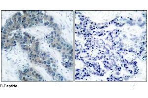 Image no. 1 for anti-Janus Kinase 2 (JAK2) (pTyr1007) antibody (ABIN196873) (JAK2 抗体  (pTyr1007))