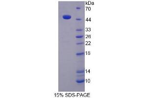 SDS-PAGE analysis of Rat KNG1 Protein. (KNG1 蛋白)