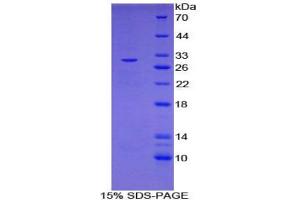 SDS-PAGE analysis of Mouse IL27Ra Protein. (IL27 Receptor alpha 蛋白)