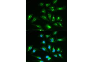 Immunofluorescence analysis of HepG2 cell using CD46 antibody. (CD46 抗体  (AA 40-320))