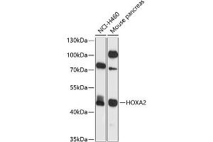 Western blot analysis of extracts of various cell lines, using HOX antibody (ABIN6128061, ABIN6141938, ABIN6141939 and ABIN6225060) at 1:1000 dilution. (HOXA2 抗体  (AA 207-376))