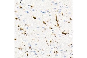 Immunohistochemistry of paraffin-embedded Human brain using CD74 antibody (ABIN7267759) at dilution of 1:100 (40x lens). (CD74 抗体)