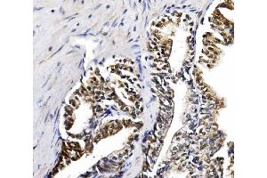 IHC analysis of NOLA1/GAR1 using anti-NOLA1/GAR1 antibody (ABIN7602076).