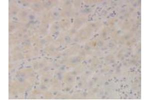 Immunohistochemistry (IHC) image for anti-Signal Transducer and Activator of Transcription 3 (Acute-Phase Response Factor) (STAT3) (AA 335-546) antibody (ABIN7444046)