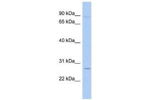 TLE4 antibody used at 0. (TLE4 抗体  (N-Term))