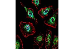 Fluorescent confocal image of Hela cell stained with TFE3 Antibody (N-term) (ABIN1538859 and ABIN2849812). (TFE3 抗体  (N-Term))