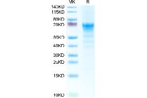 SDS-PAGE (SDS) image for Cytotoxic and Regulatory T Cell Molecule (CRTAM) (AA 17-289) protein (His tag) (ABIN7274417)
