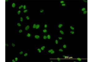 Immunofluorescence of monoclonal antibody to DDX41 on HeLa cell. (DDX41 抗体  (AA 523-622))