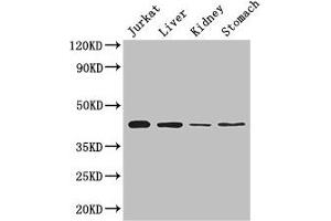 Western Blot Positive WB detected in: Jurkat whole cell lysate, Mouse liver tissue, Mouse kidney tissue, Mouse stomach tissue All lanes: Hoxa2 antibody at 2 μg/mL Secondary Goat polyclonal to rabbit IgG at 1/50000 dilution Predicted band size: 42 kDa Observed band size: 42 kDa (HOXA2 抗体  (AA 26-124))