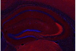 Indirect immunostaining PFA fixed mouse hippocampus section (dilution 1 : 500; red).