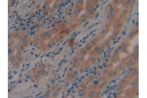Immunohistochemistry (IHC) image for anti-Adenylate Cyclase 3 (ADCY3) (AA 501-736) antibody (ABIN7441868)