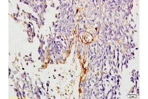 Immunohistochemistry (Paraffin-embedded Sections) (IHC (p)) image for anti-Collagen, Type IV (COL4) (AA 1571-1669) antibody (ABIN707396)