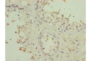 Immunohistochemistry of paraffin-embedded human testis tissue using ABIN7159960 at dilution of 1:100 (PMPCB 抗体  (AA 110-380))