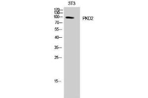 Western Blotting (WB) image for anti-Polycystic Kidney Disease 2 (Autosomal Dominant) (PKD2) (Tyr654) antibody (ABIN3176934) (PKD2 抗体  (Tyr654))