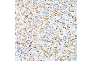 Immunohistochemistry of paraffin-embedded rat ovary using Sec23AA Rabbit mAb (ABIN7270168) at dilution of 1:100 (40x lens). (SEC23A 抗体)