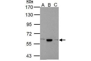 Western Blotting (WB) image for anti-Calcium Channel, Voltage-Dependent, beta 4 Subunit (CACNB4) (C-Term) antibody (ABIN2854649)