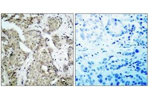Immunohistochemistry (IHC) image for anti-Mitogen-Activated Protein Kinase Kinase 3 (MAP2K3) (pSer189), (Ser207) antibody (ABIN1847502)