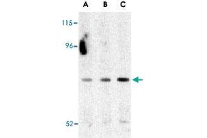 Western blot analysis of ATG7 in Caco-2 cell lysate with ATG7 polyclonal antibody  at (A) 0.