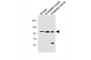 Western Blotting (WB) image for anti-Colony Stimulating Factor 1 Receptor (CSF1R) (AA 895-923), (C-Term) antibody (ABIN657832)