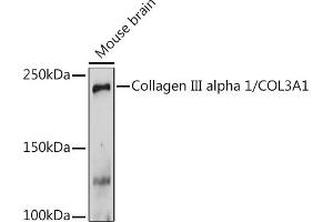 Western blot analysis of extracts of Mouse brain, using Collagen III alpha 1/COL3 Rabbit pAb (ABIN1679317, ABIN3018108, ABIN3018109 and ABIN6220366) at 1:1000 dilution. (COL3A1 抗体  (AA 1217-1466))