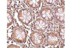Immunohistochemistry (IHC) image for anti-CD248 Molecule, Endosialin (CD248) (N-Term) antibody (ABIN1031609) (CD248 抗体  (N-Term))