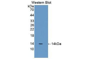 Western Blot; Sample: Recombinant protein. (beta-2 Microglobulin 抗体  (AA 22-119))