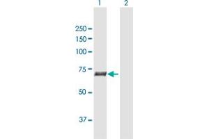 Western Blotting (WB) image for anti-Solute Carrier Family 27 (Fatty Acid Transporter), Member 5 (SLC27A5) (AA 1-690) antibody (ABIN949023)